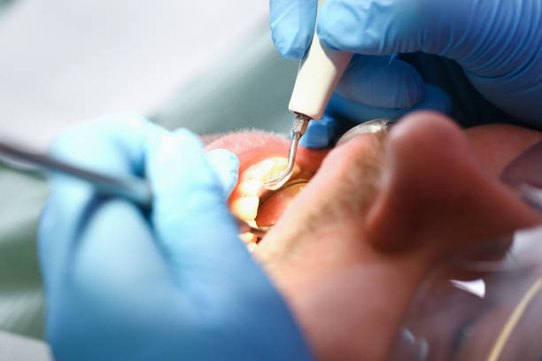 Best Dentist for Dental Trauma  in Columbus, OH