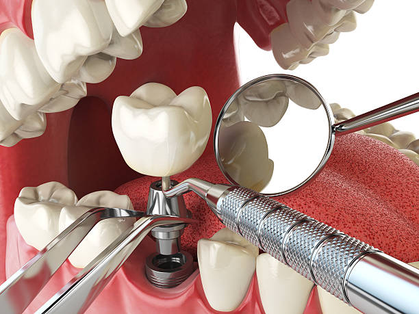 Best Emergency Tooth Extraction  in Columbus, OH